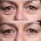 Wrinkles Schminkles Under Eye Patches - Rejuvenate Wrinkles with Medical Grade Silicone Reusable Anti-Wrinkle Patches for Under Eye Treatment, Banish Dark Circles (3 Pairs)