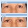 Retinol Face Renewal Skin Care Set - Micro Exfoliate, Resurface &amp; Hydrate for Radiant Skin - Encapsulated Retinol for Fine Lines &amp; Wrinkles - Serum, Moisture Cream &amp; Cleanser Wash - Serious Skincare