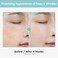 Pore Refiner Cream, Face Cream, Pore Extractor, Pore Minimize &amp; Reducer and Remover. Best Pore Minimizer Treatment. Moisturizer for Oily Skin. K Beauty, Korean Skincare, 50g, 1.76 oz.