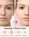 Pimple Patches Acne Patches for Face, 4 Sizes 360 Patches Hydrocolloid Acne Cover Patch, Clear Easy To Peel Acne Absorbing Zit Patch with Tea Tree &amp; Calendula Oil