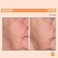 Serious Skincare - Vitamin C Face Cream for Women and Men - Hydrates Dry Skin - Anti-Aging Wrinkle Moisturizer for Radiant Skin - Vitamin C3 Esters - Hydrolyzed Collagen - Daytime SPF 30-2 Fl. Oz.