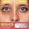 Under Eye Patches for Dark Circles, Puffiness and Eye Bags with 24K Gold - Anti-Wrinkle for Puffy Eyes, Eye Masks with Hyaluronic Acid and Collagen Hydrogel Eye Gel Pads, Premium Korean Skincare 30pcs