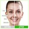 Dead Sea Mud Mask for Face and Body, Deep Cleansing Facial Clay Mask for Acne, Blackheads, Whitehead, Oily Skin, Minimize Pores, Moisturizing, Natural Skin Care for Women and Men, 5.29oz/150g