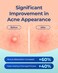 Pimple Patches for Face Acne: 0.1mm Ultra-Thin Hydrocolloid Zit Stickers with Tea Tree Oil - 44 Invisible Dots, 2 Sizes (Whiteheads/Sensitive Skin)