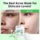 IREV Anti Acne Face Mask,Sheet Masks With Salicylic Acid, Face Masks Skincare For Acne, Acne Sheet Mask for Acne-Prone, Oily, and Sensitive Skin, Deep Pore Cleansing Facial Mask 10 Sheets