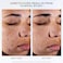 Lanc&ocirc;me Clarifique Pro-Solution Face Serum - Facial Serum For Visibly Reducing Dark Spots &amp; Acne Spots - With 10% PHA and Niacinamide - 1.7 Fl Oz