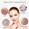 AICHUN BEAUTY Face Serum Natural Rice Extract Hydrate Moisturizing Anti-Acne Anti-Oxidation Refine Wrinkles 40ml/1.35fl.oz