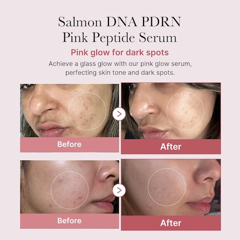 medicube Salmon DNA PDRN Pink Peptide Serum, Pink glow serum, Peptide, Niacinamide, Hydrating &amp; Moisturizing &amp; Firming, Uneven Skin Tone, Korean Skincare   1.01 fl.oz. (1.01 fl.oz., Salmon DNA PDRN)
