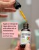 Rosehip Oil for Face - Unrefined &amp; Cold Pressed Essential Oil from the Seed - Nourishing for Skin &amp; Hair - USDA Certified Organic &amp; 100% Pure - 1 Oz