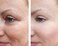 Vitality Precision Skin Phloretin C Serum