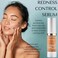 RD Alchemy - 100% Natural &amp; Organic Redness Control Serum - Chamomile and Lavender Calm &amp; Soothe Heat and Irritation - Great for Calming Red, Irritated, or Swollen Skin