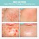Heartleaf Tea Tree Tok, Acne Treatment, Soothing Toner Serum, Centella Asiatica, Korean Facial Skincare for Pore Control, Calming, Nourishing. 50ml, 1.69 fl. oz.