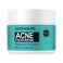 Acne Treatment Cream for Face, Back, Butt, Body - Spot Treatment for Pimples, Blemishes, Blackheads, Oil Control - Natural Ingredients - for Teens, Women, and Men