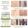 Spider Veins Repair Cream for Legs - Varicose &amp; Spider Veins Leg Treatment (50g)