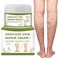Spider Veins Repair Cream for Legs - Varicose &amp; Spider Veins Leg Treatment (50g)