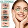 VANELC Eye Mask,Under Eye Patches with Collagen Seaweed,Eye Gel Treatment Masks For Dark Circles , Under Eye Bags Treatment, Natural Eye Masks for Puffy Eyes, Under eye Dark Circles,Anti-Wrinkle