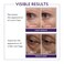 Westmore Beauty 60 Second Eye Effects - Eye Serum - Under Eye Cream - Instant Eye Tightening Serum &amp; Instant Eye Bag Remover Puffiness - Light to Medium - Firming Serum 0.68 fl oz / 20 mL