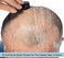 Premium Omnishaver with Cartridge Kit - The Fastest Way to Shave Head, Legs, Arms, Body an Alternative to Disposable Shaving Razors Self Cleans &amp; Strops During Use with Durable Blade Bald Head Shaver