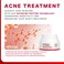 JEU'DEMEURE Korean skin care Acne Control Treatment Oil-Free Cream for Sensitive Skin, Pimple Breakout, Peptide, Calming, Blemish Acne 1.69 fl oz