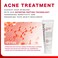 JEU'DEMEURE Korean skin care AC Control Gel Acne Treatment for Sensitive Skin, Pimple Breakout, Peptide, Calming, Blemish Acne 2.53 fl oz