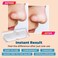 MEDca Deep Cleansing Blackhead Pore Strips - Pack of 48 Peel - Off Blackhead Remover and Pore Unclogging Strips for Nose and Face, Chin, Forehead &amp; Healthier Looking Skin