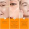 Vitamin C Face Serum With Hyaluronic Acid, Anti Aging Facial Serum with Retinol and Niacinamid, Salicylic Acid Anti Acne Facial Serum, Vitamin C Serum for Even Skin Tone, Hydrating Skin, 1Fl Oz