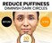 Stylia Under Eye Patches for Dark Circles and Puffy Eyes (30 Pairs), 24k Gold Eye Mask for Dark Circles and Puffiness, Vitamin C, Hyaluronic Acid, Pearl Extract, Collagen Eye Gel Pads for Puffiness