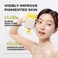 Niacinamide 5% Brightening Body Lotion (10.14 fl oz / 300ml) &ndash; Even Skin Tone Antioxidant-Rich Lotion for Women, Vitamin C Lotion for Radiant Skin, Body Moisturizer, Korean Skincare