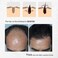 Lanthome Hair Growth Spray, Organic Onion Oil with Rosemary Scent, Enriched with Black Seed Oil, Controls Hair Loss, Promotes Growth, for Women and Men