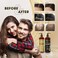 DHT Pro Shampoo and Conditioner Advanced Formula with Procapil and Capixyl, DHT Blockers and Natural Extracts, Hair Loss Solution for Men and Women, Stimulates Follicles, Prevents Thinning Hair