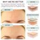 Dermaclara Face Patches Kit - Anti Wrinkle Patches for Forehead, Smile Lines, Silicone Anti-Wrinkle Frown Line Treatment, Up to 30 Uses - 1 Forehead, 2 Mouth, 2 Eye, 1 Neck &amp; 1 Patch Prep Cleanser