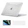 EooCoo Glitter Case Compatible with MacBook Pro 13 inch M2 2024 2023 2022-2016 M1 A2338 A2289 A2251 A2159 A1989 A1706 A1708 Sparkly Hard Case with Keyboard Cover, Screen Protector