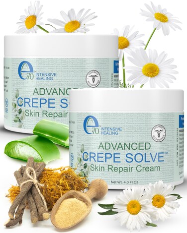 Advance Crepe Solve Body Cream for Women &amp; Men - Made with Natural Oils, Licorice Root &amp; Chamomile Extract - Moisturizer for Dry Skin, Crepey Skin &amp; Stretch Marks, 2-Pack