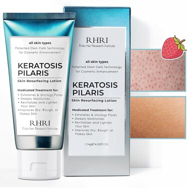 Keratosis Pilaris Lotion with Glycolic Acid, AHA &amp; BHA Exfoliating   Strawberry Legs, KP &amp; Ingrown Hair Treatment   Bumpy Skin Body Lotion   Moisturizing Cream for Redness, Dry, Rough &amp; Flakey Skin