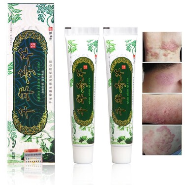 Oversea Thousand-Year Herbal Cream Chinese Herbal Eczema, Psoriasis Creams Dermatitis and Eczema Pruritus Psoriasis JIULIN Ointment (2PCS)