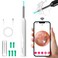 Aoriko Ear Wax Removal Tool,Ear Cleaner with Camera,Earwax Removal Kit with Light,Wireless Ear Scope for iOS&amp;Android,Insects &amp; Plant Microscopes,Visual Earwax Removal Kits (White)