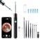 Ear Wax Removal - Earwax Remover Tool with 8 Pcs Ear Set - Ear Canal Cleaner with 1080P Camera - FSA HSA Eligible - Ear Cleaning Kit with 6 Ear Spoon - Ear Camera for iOS &amp; Android (Black)
