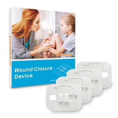 Emergency Wound Closure Strips - 4 Pcs Zip Stitch Wound Closure Strips - Laceration Closure Kit for Wound Care - Butterfly Bandages Quick Clot Bandaids