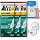 GIGIS No-Drip Severe Congestion 12 Hour Nasal Spray, 3x20mL Bundle Anti-Snoring Nose Clip &amp; Nasal Strip (3 Items)