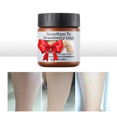 Strawberry Legs Treatment Cream For Women Keratosis Pilaris Lotion Chicken Skin Treatment Moisturizing Strawberry Skin Smooth Radiant Skin Care Solution Exfoliating Body Cream for Dry Skin