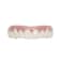 Imako Premium Cosmetic Uppers for Men and Women Temporary Smile Makeover 1 Pack Small Bleached White Made in USA