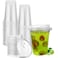 Artpreti 12 oz Clear Plastic Cups with Strawless Sip Lids Disposable Plastic Coffee Cups with Lids To Go Cups for Iced Coffee Smoothies Soda or Any Cold Drinks 25Sets