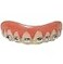 Billy-Bob Billy Bob FoolAll Braces