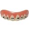 Billy-Bob Billy Bob FoolAll Braces