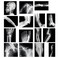 Sayglossy 15 Pcs Broken Bones x Ray Set Human x Rays Black and White Skeleton Pretend Xrays for Kids