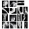 Sayglossy 15 Pcs Broken Bones x Ray Set Human x Rays Black and White Skeleton Pretend Xrays for Kids