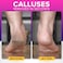 NYK1 RUSTPROOF Foot File Callus Remover for Feet with Skin Catcher XL Size MEGAFILE Foot Callus Remover for Wet Dry Use HighPerformance Feet Scrubber with Textured Grip for NonSlip Control