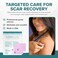 BIODERMIS EpiDerm Patch ProfessionalGrade Silicone Scar Sheets for Small Keloid Hypertrophic Scars Soft Flexible Reusable Scar Treatment Custom Fit UltraThin Discreet 2 x 25 Clear 1 Pair
