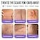 AWD Medical AWD Silicone Scar Tape 3 Pack 3x 60in Rolls Reusable Silicone Scar Sheets for Surgery Keloids Tummy Tuck Scar Tape for Bump Removal Postpartum Essentials 180in Total