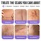 AWD Medical AWD Silicone Scar Tape 3 Pack 3x 60in Rolls Reusable Silicone Scar Sheets for Surgery Keloids Tummy Tuck Scar Tape for Bump Removal Postpartum Essentials 180in Total